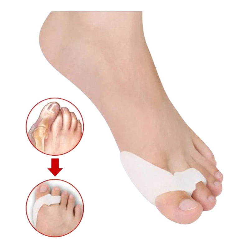 Corrector De Juanetes Separador Ortopédico Dedos Pies Suppro