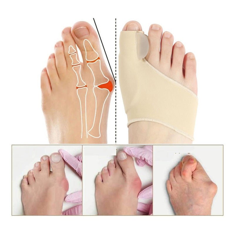 Separador Corrector Juanete Ortopédicoajuste Pulgar - Image 2
